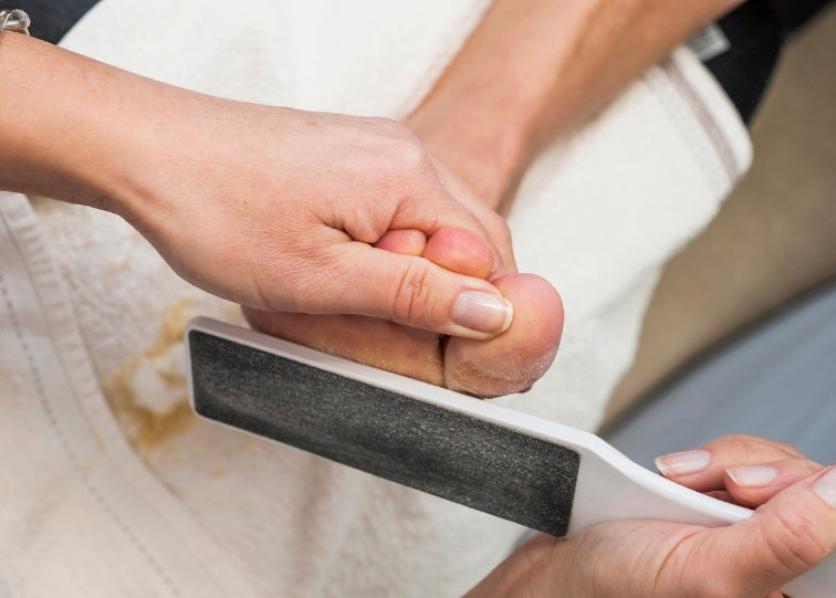 Calluses: Why They Form and How to Treat Them Effectively