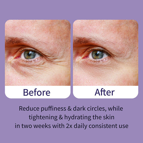 Ebanel Perfection Eye Serum before and after photo