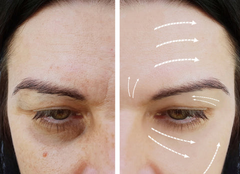 How to do a chemical peel